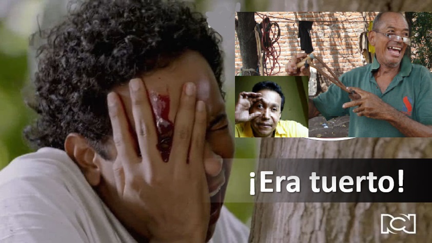 Tuerto cacique